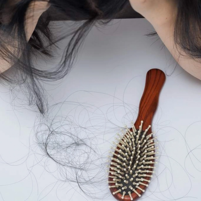 Chute de cheveux - laboratoire de biologie marine détox en France Image Chute de cheveux